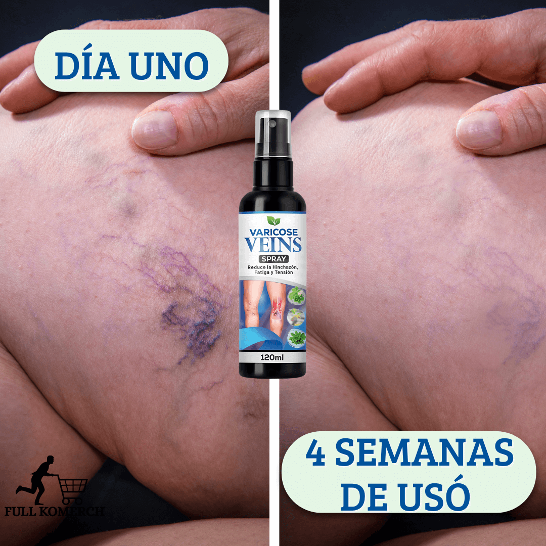 VARICOSE VEINS X120 ml Adiós a las Varices