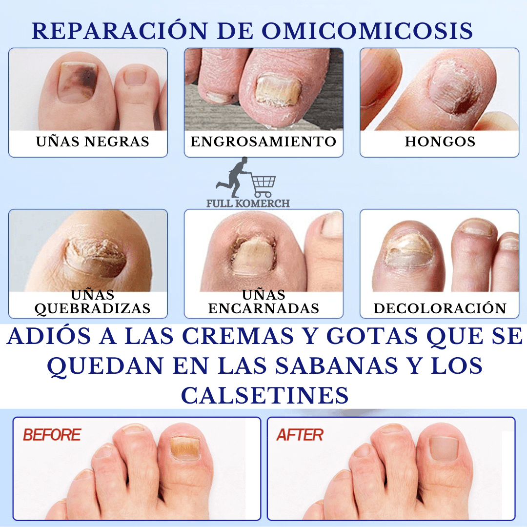 FUNGALNAIL® Anti Hongos X 21 Parches