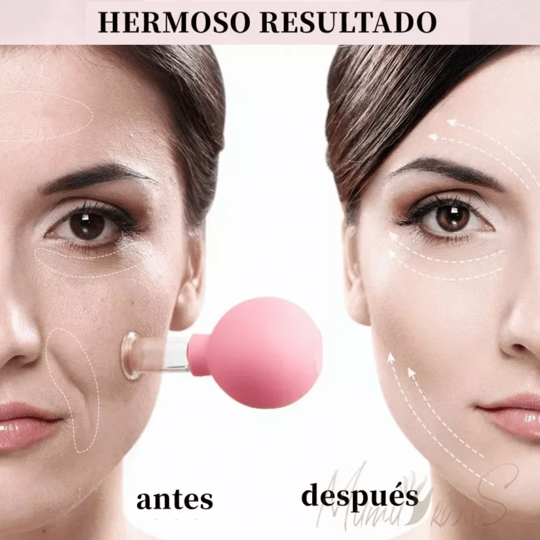⚕️Ventosas Drenaje Facial💫 X 4 +🎁